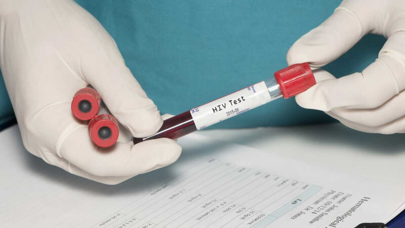 В январе в Могилеве диагностировано 9 новых случаев ВИЧ