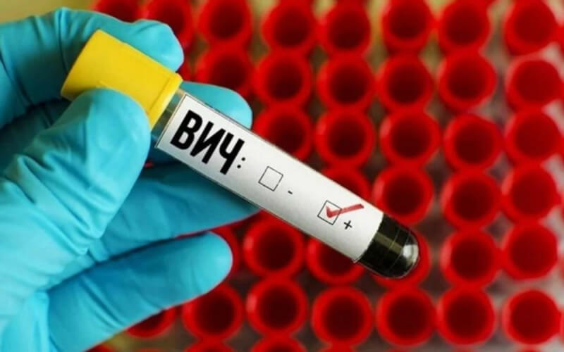 174 жителей Могилевщины заболели ВИЧ выявлено в 2020 году