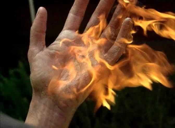 Могилевчанин получил ожоги 12% тела: мыл руки растворителем и курил