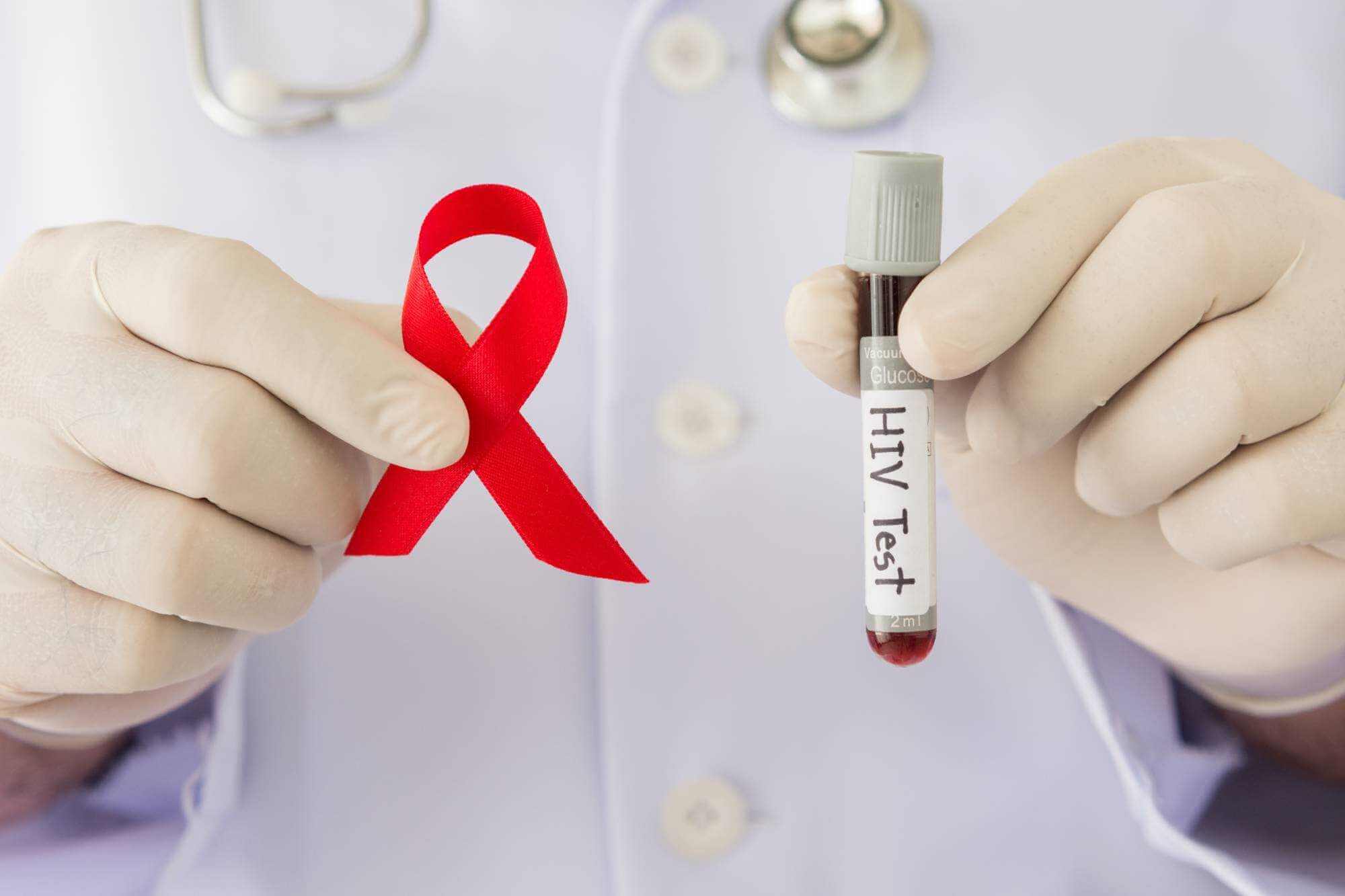 37 новых случаев ВИЧ диагностировано на Могилевщине с начала года