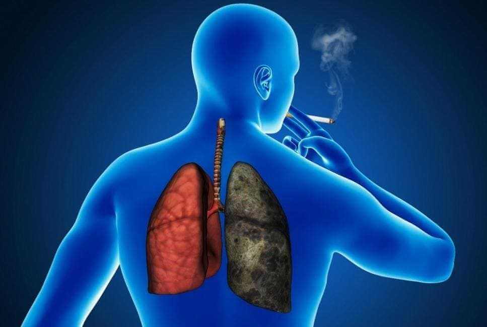 Каждый восьмой курильщик сигарет заболевает раком легких