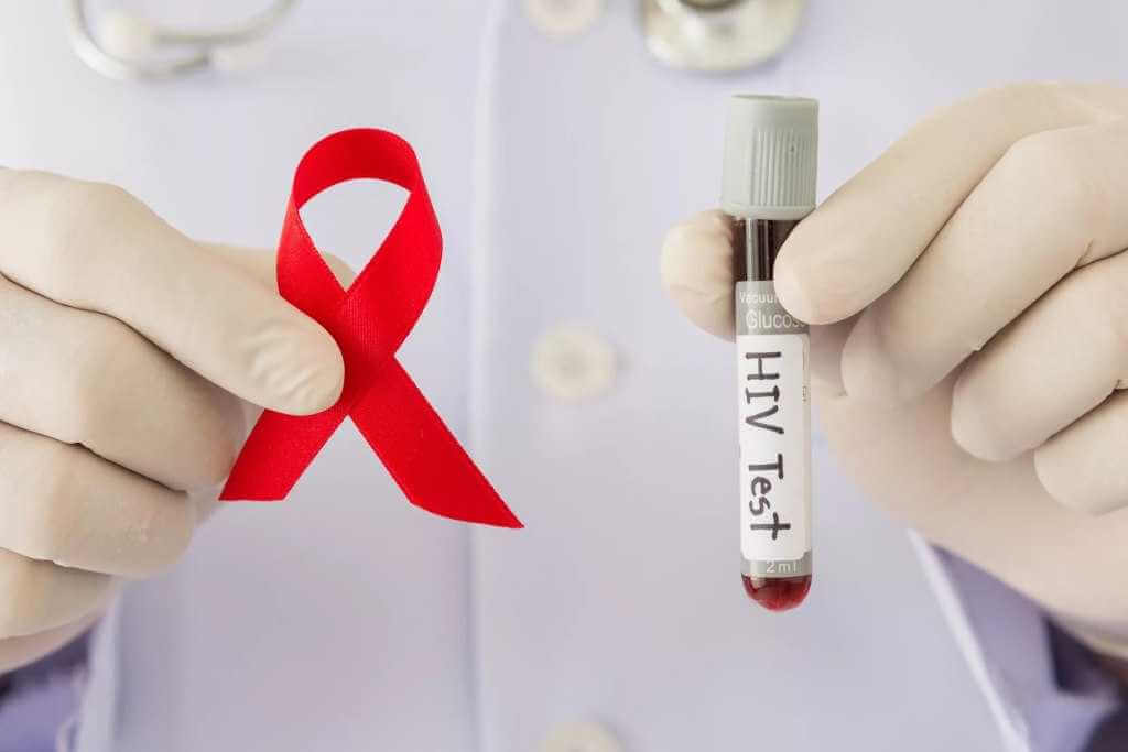 146 случаев ВИЧ-инфекции зарегистрировано в Могилевской области с начала 2023 года