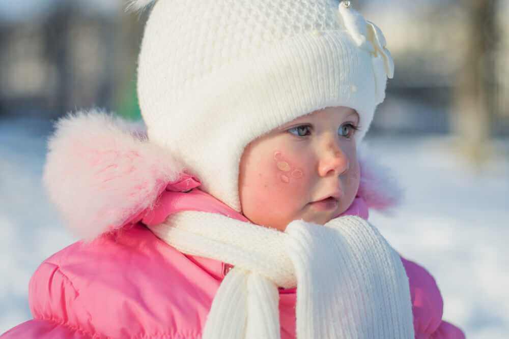 Как избежать обморожение ребенка в зимние морозы. Советы могилевского врача-педиатра