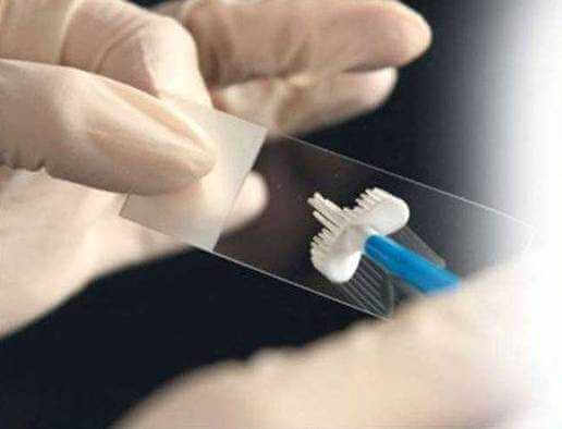 Бесплатный тест на вирус папиломы человека проводят в Могилеве