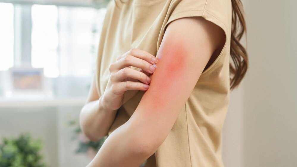 Когда стоит записаться к аллергологу: симптомы, диагностика и лечение