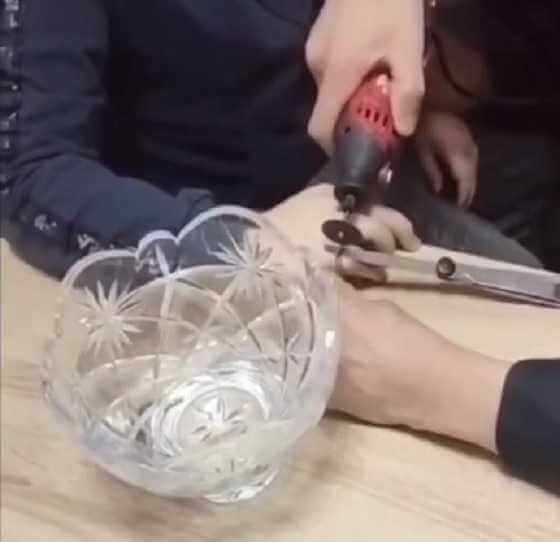 На Могилевщине на пальце мальчика застрял гардеробный номерок — пришлось вызывать спасателей